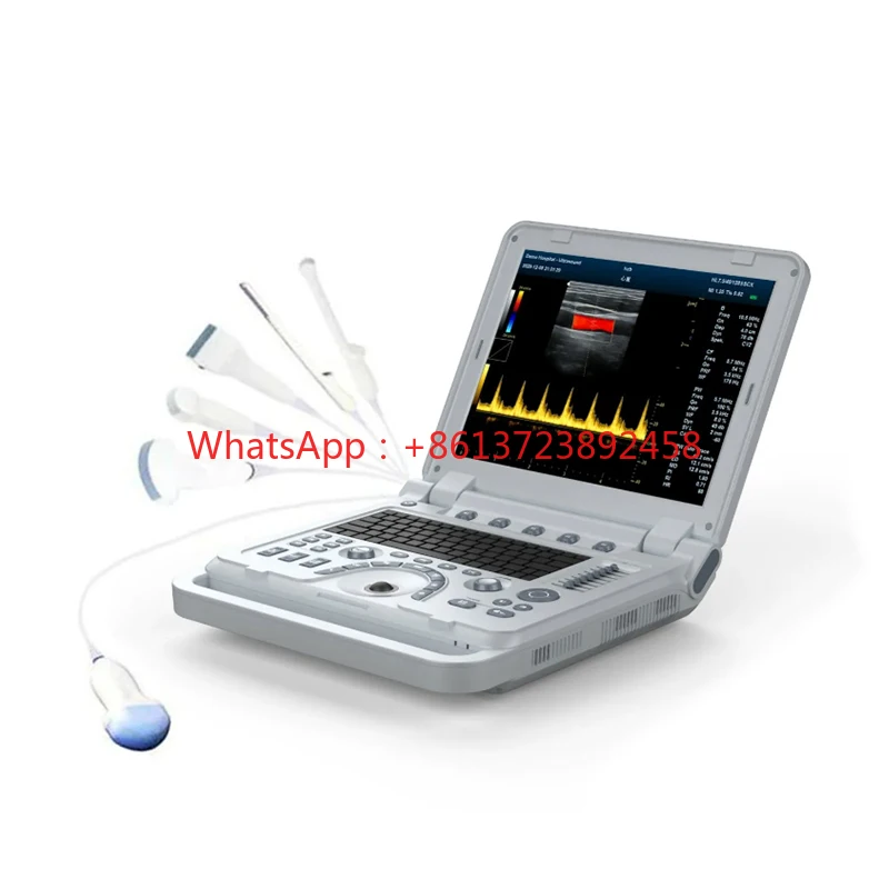 YSB1700B OB/GYN Ultrasound machine portable diagnosis 4D Color Doppler ultrasound machine for body human mini ultrasound machine