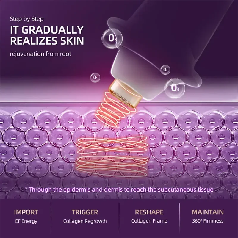 HIFU Skin Care Radio Frequency Face Lifting EMS Microcurrent Skin Tightening Anti Wrinkle Skin Rejuvenation Beauty Oxygen Pen