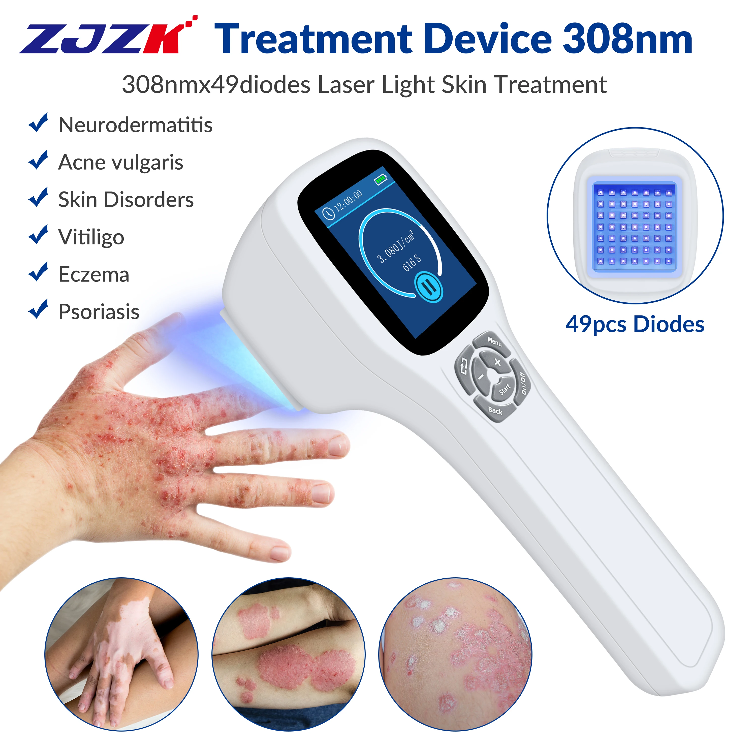 

ZJZK Laser Therapy To Lighten Skin Phototherapy UV Light 308nmx49diodes Box For Psoriasis Furuncle Lymphoproliferative Disease