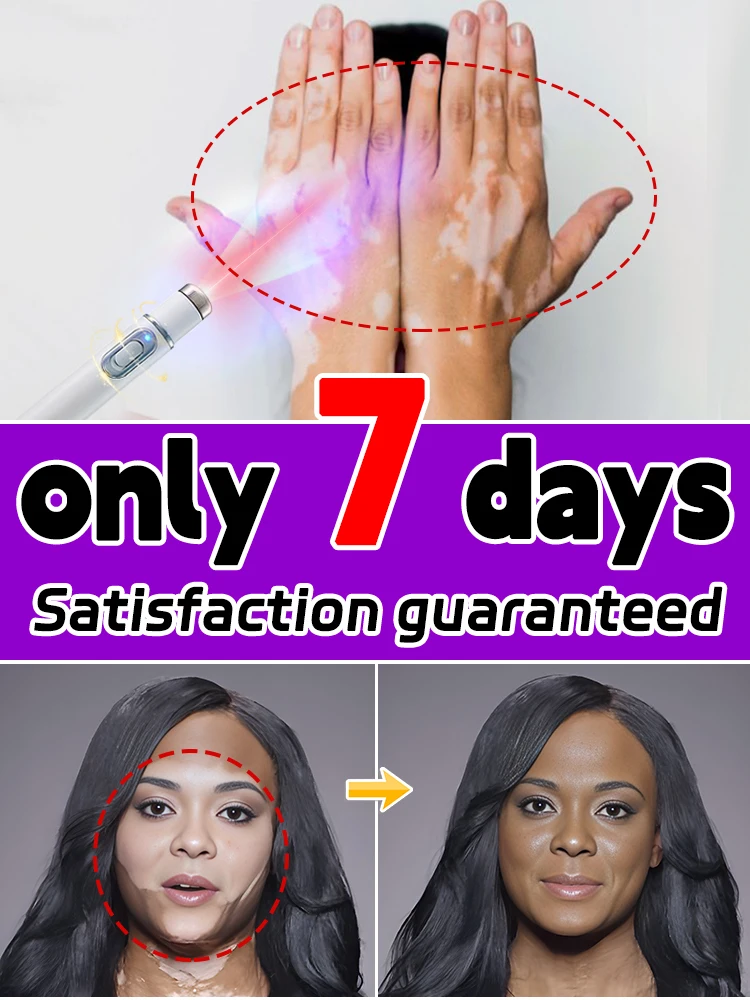 

Just 7 days brings a difference