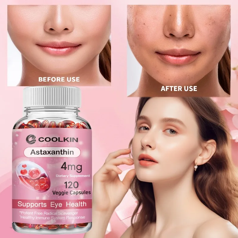 

Astaxanthin 4 Mg - Supports Eye Health, Joint Health, Internal Circulation, Skin Health, Boosts Immunity, Improves Digestion