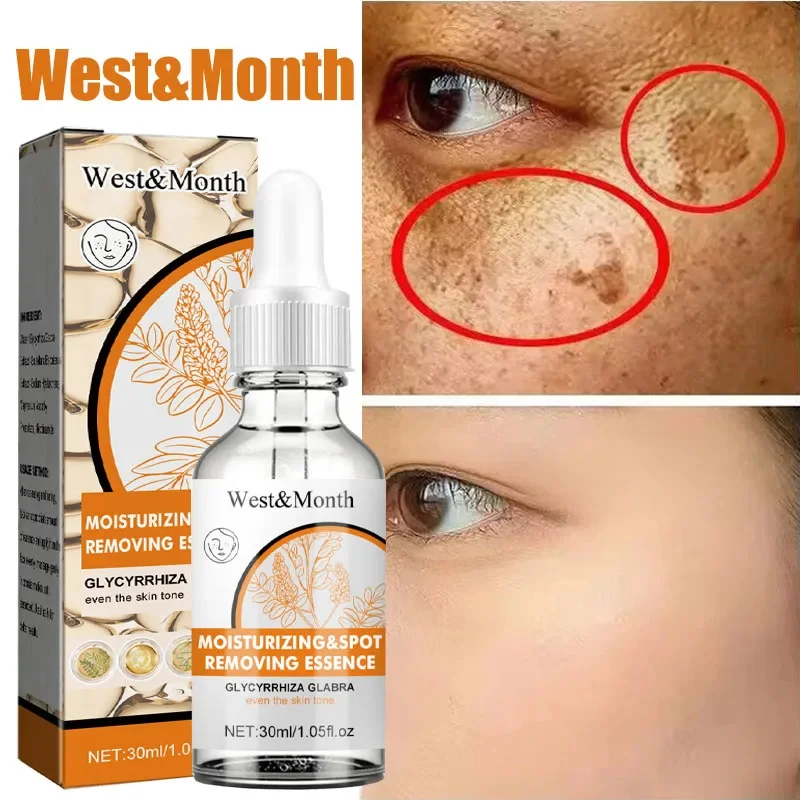 

Nicotinamide Whitening Face Serum Remove Dark Spots Freckles Fade Melanin Essence Brighten Anti Aging Korean Skin Care Products