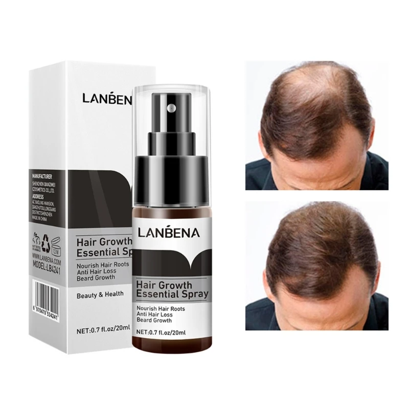 LANBENA Hair Growth Product Fast Growing Scalp Treatments Oil Beauty Health Hair Care for Men Women 20ml