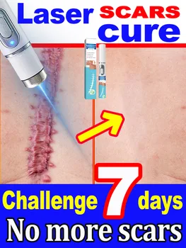 PAINLOSE LASERSCHAFTEN