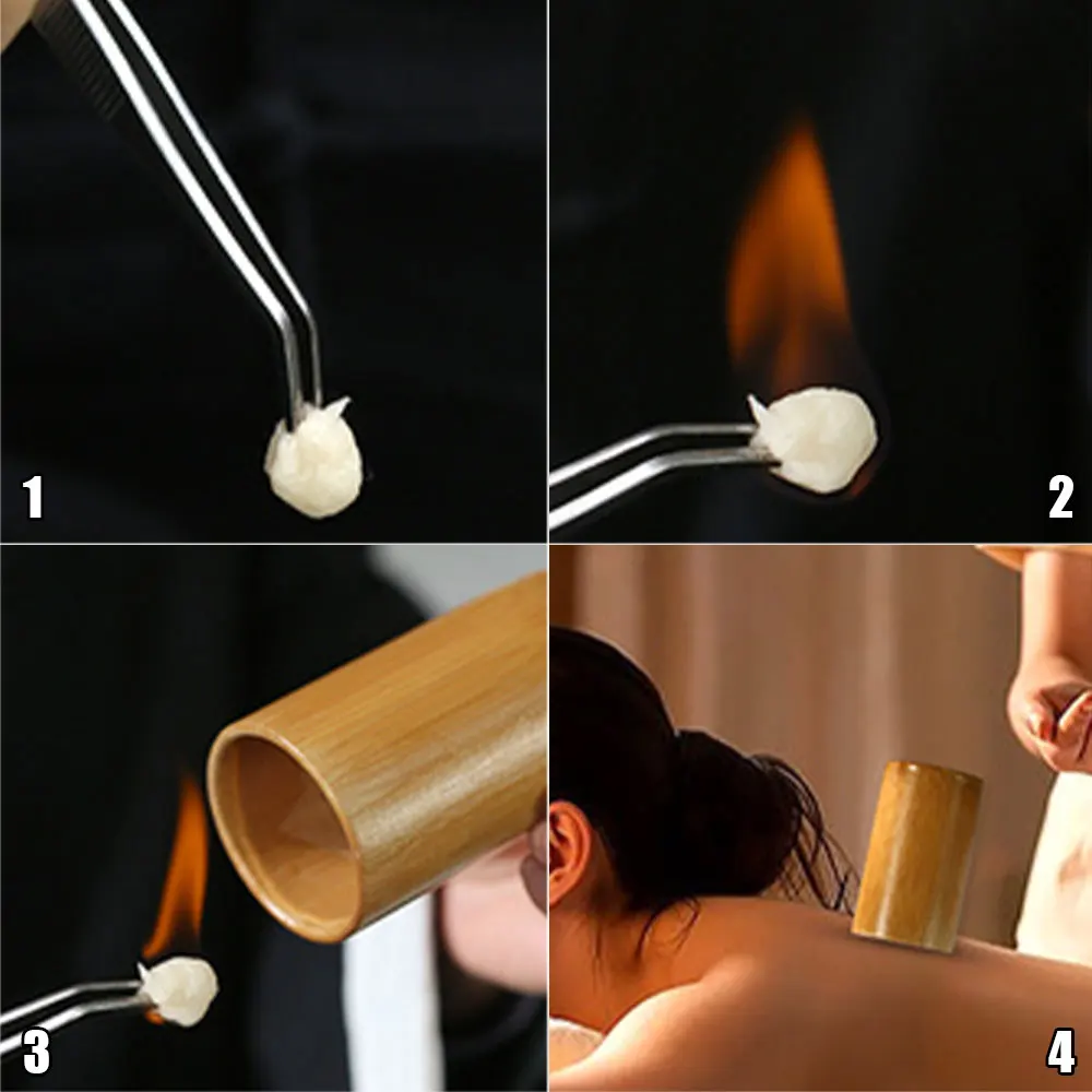 Traditionelles chinesisches Glas-Feuer-Schröpfset, Körpertherapie, Cellulite-Set, karbonisierte Bambus-Saugnäpfe, Akupunktur-Massage