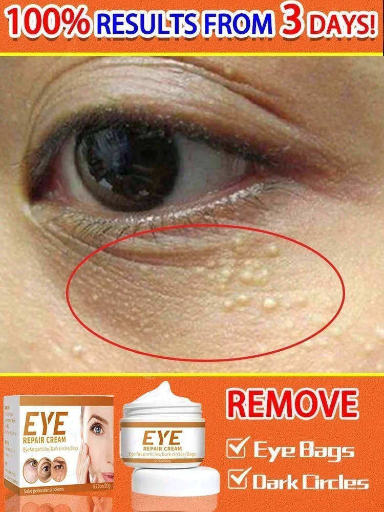 

Wrinkle removing eye cream package, dark circles under the eyes method, eye fundus work, moisturizing, whitening and skincare