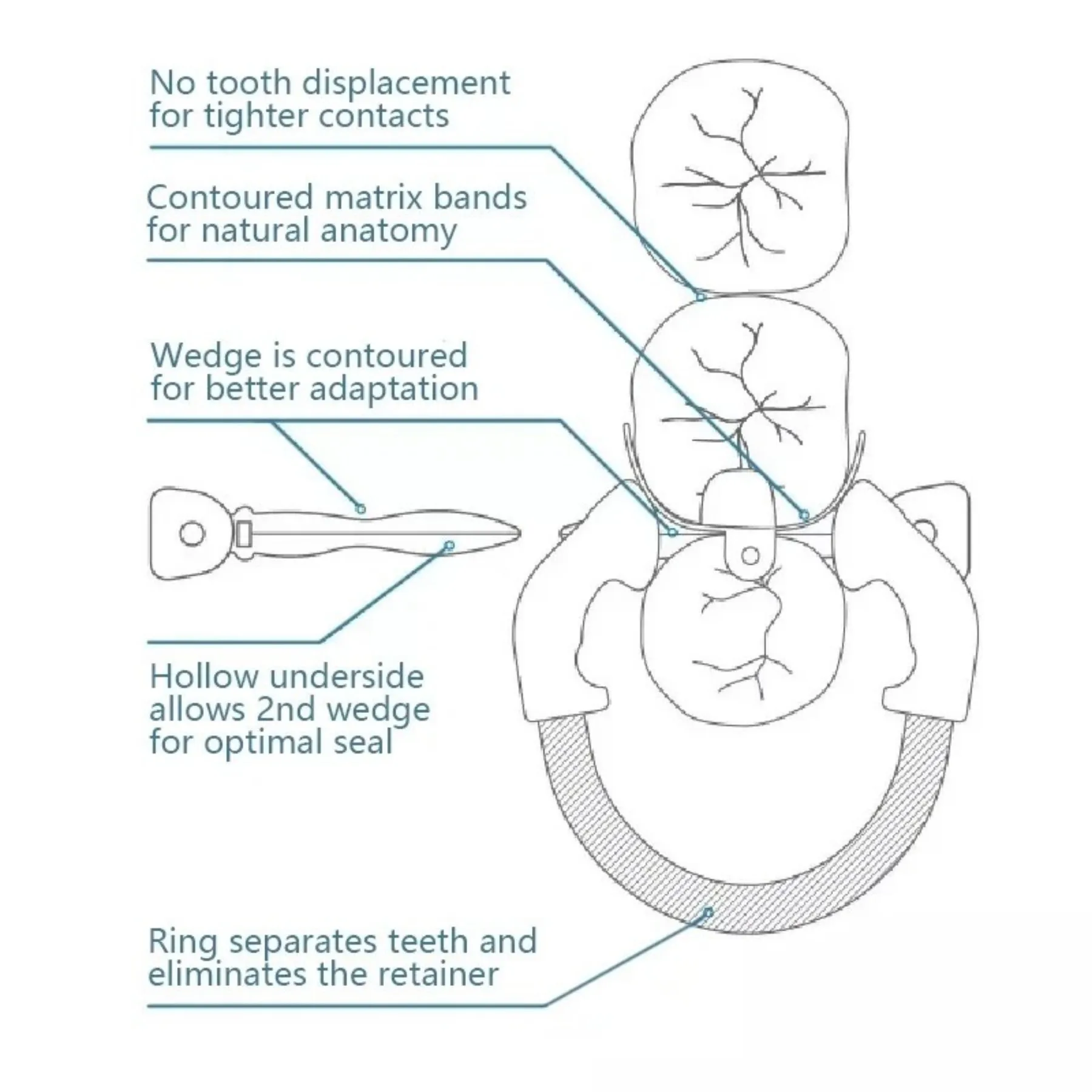 C2 Dental Sectional Matrix System M4 1.0 Matrix Bands with R6 Clamps Ring 100pcs+2pcs Kit Fit Garrison Palodent V3 System - view 3