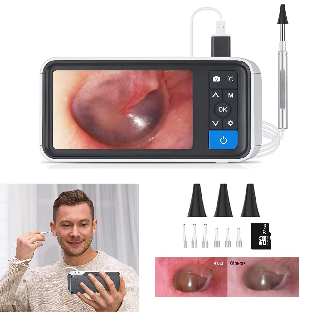 3.9mm 4.5 Inch IPS Color Screen Smart Digital Video Otoscope 1.0MP 1080P HD Lens with Ear Inspection Camera 6 LED Endoscope D3
