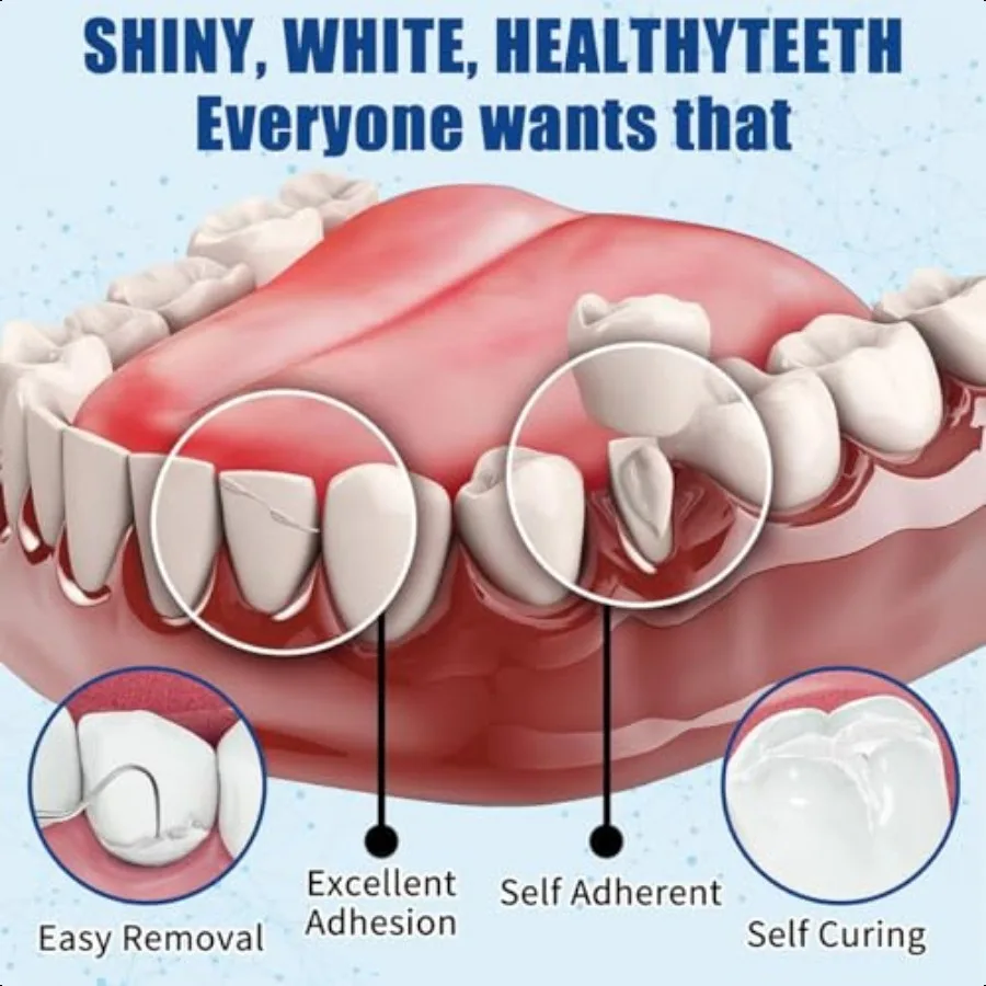 折れた歯の修理キット 酸化亜鉛 エウゲノールセメント デンタルケアキット 一時的な固定クラウンとブリッジ 2パック