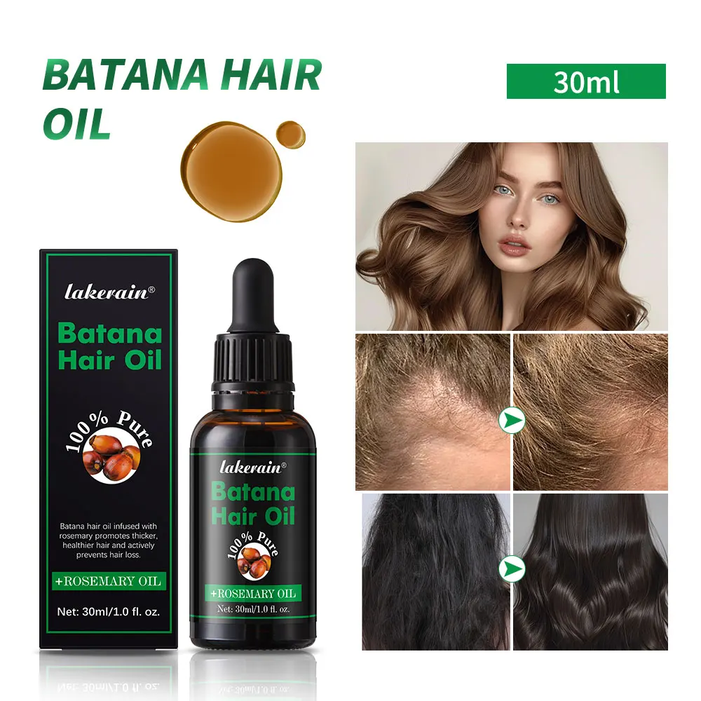 

Fast Hair Growth Oil Africa Crazy Traction Alopecia batana Hair Mask Anti Hair Break Hair Strengthener Hair Loss Treatment Spray