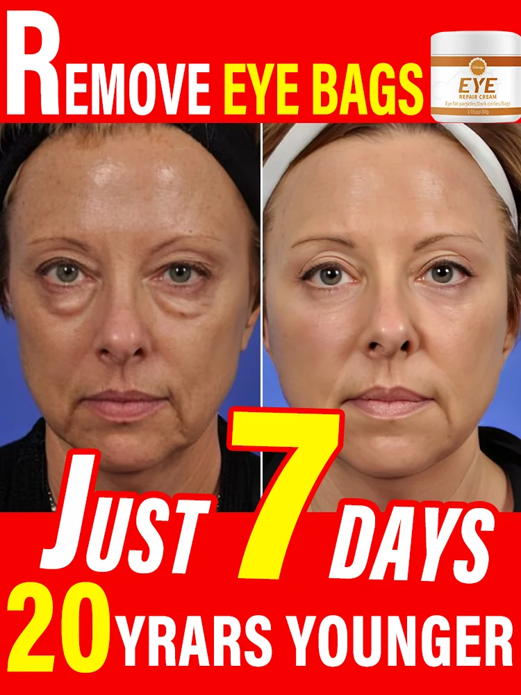 

Instant Repair Facial Redness Cream Soothing Redness Repair Skin Rosacea Red Blood Improve Sensitive Skin Care Korean Cosmetic