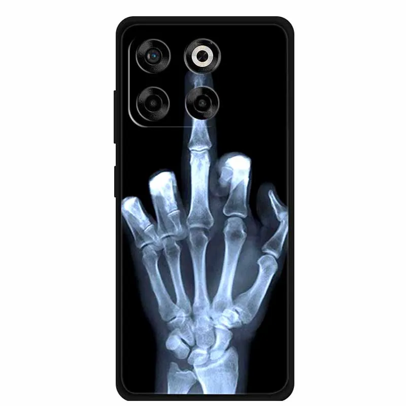 حافظة لهاتف ZTE Blade A35 A55 A 35 55 Coque غطاء خلفي ناعم من السيليكون الأسود لهاتف ZTE Blade V70 Axon 70 حافظة هاتف V 70 Funda