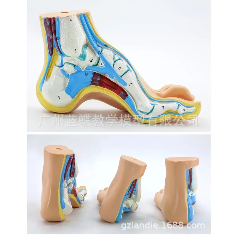 Medical Human  Sketelon  Flatfoot, Arch Foot and Normal Foot Anatomy Model with Muscles and Joints for Educational Purposes