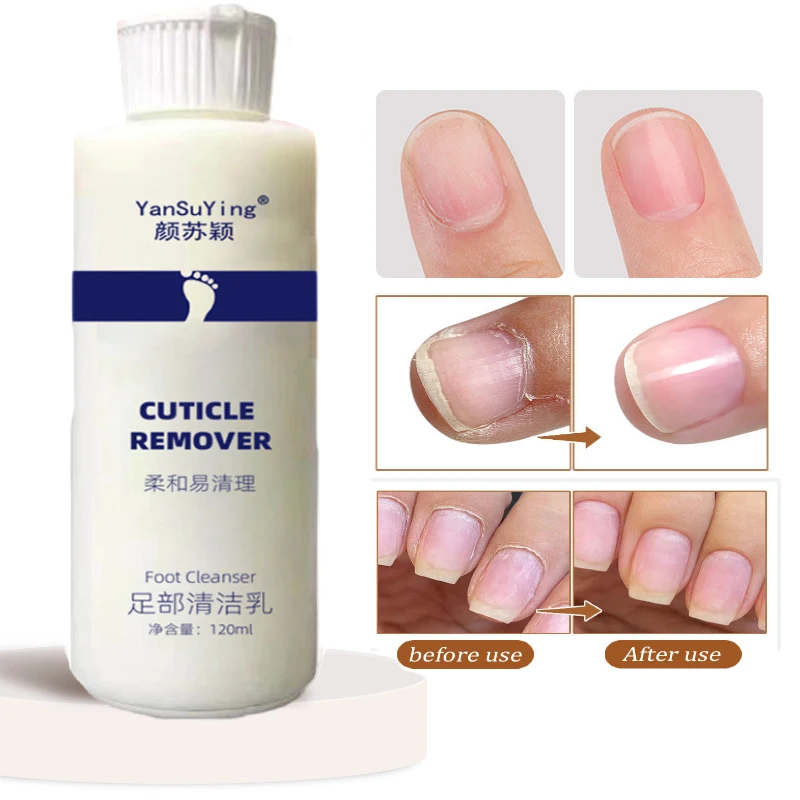 Kit de pédicure anti-fissure pour les ongles, expanseur pour les pieds, adoucissant, 7 secondes, élimination de la fréquence, peau et callosités,