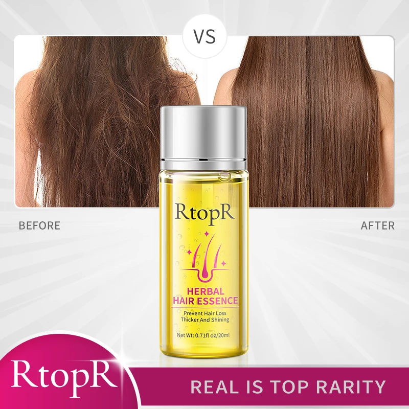 RtopR Herbal Rebirth Growth Hair Thick Essence Prevent Hair Loss Promote Shining  Scalp Repair Regrowth Nourish  Essential Oil