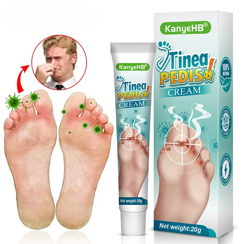 Foot Deodorant Cream Foot Odor Bacteriostasis Antipruritic Athlete's Foot Ointment Skin Topical Cream Personal Health Care