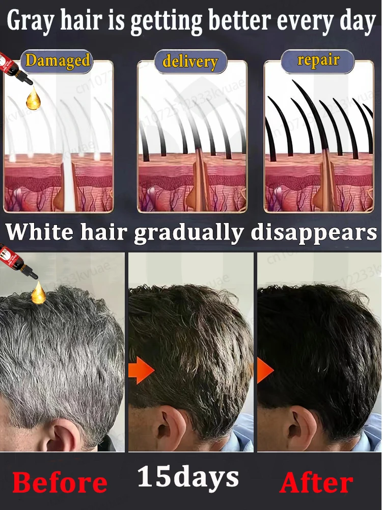 Anti-grey hair essence, restore natural hair color and restore healthy hair