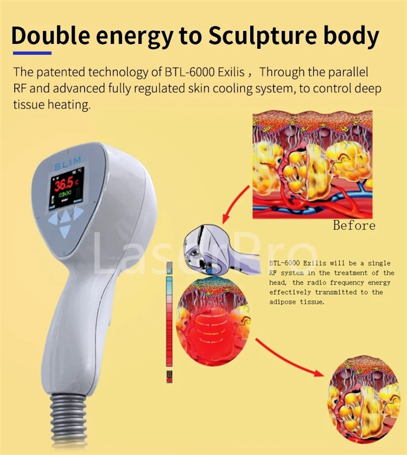 Professional 2-in-1 Ultra Exilift 360 RFrequency Machine Body Slimming Face Lifting Anti-Aging Skin Tightening Machine Salon Use