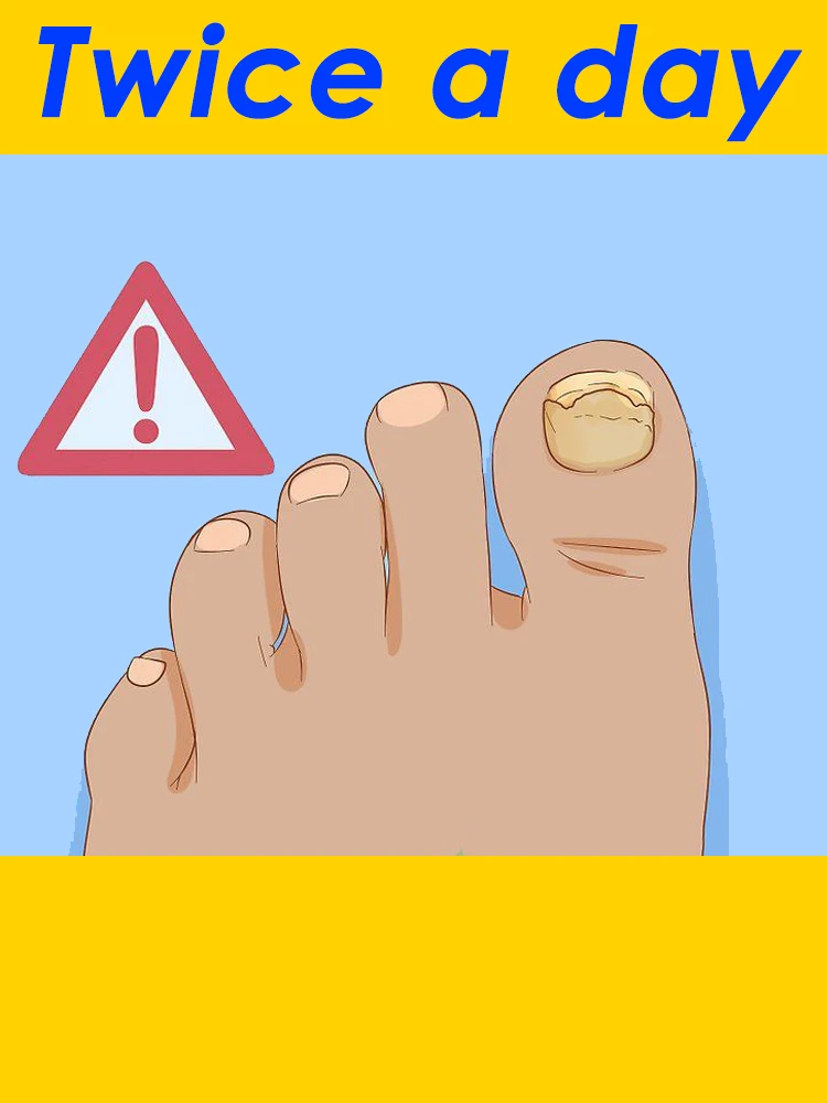 

2025 Toenail Fungus Patch Waterproof Nail Repair Patches Nail Ingrown Correction Sticker Discolored Damaged Nail Foot Care Tool