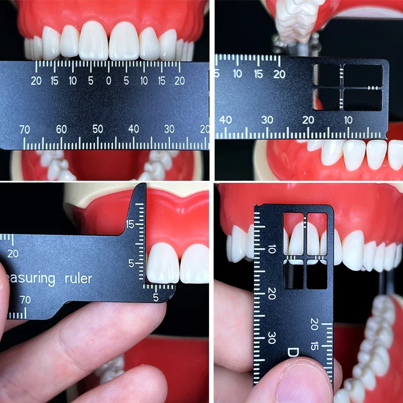 Autoclavable Dental Precision Teeth Measuring Ruler for Dentistry Photography Tooth Measurement and Calibration