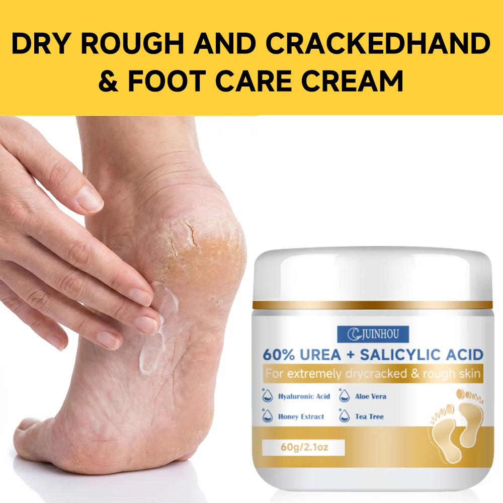 JUINHOU Urea Moisturizing Foot Balm Moisturizer Peeling Skin Soothe Dry Feet Soften Heels Pedicure Cream Full Family Foot Skin