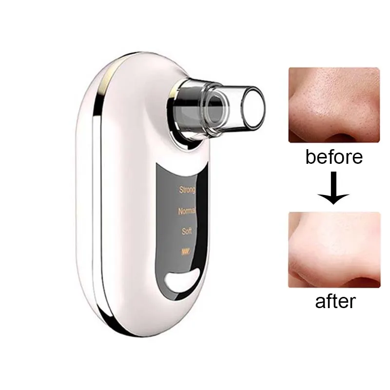 USB 충전식 전동 코 흡입기 진공 블랙헤드 제거기 및 모공 클리너 여드름 치료 기기
