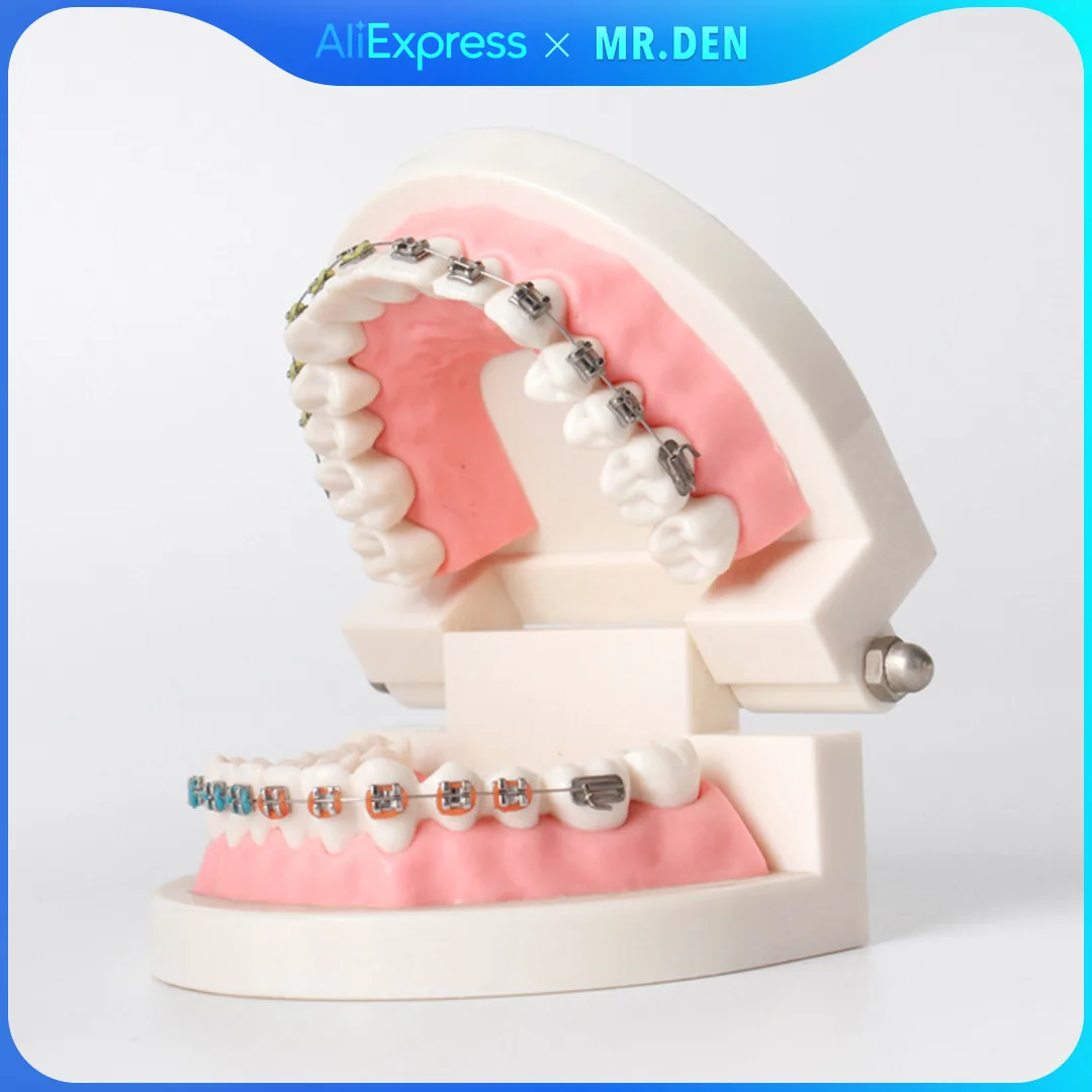 

MR DEN Dental Orthodontic Treatment Model With Ortho Metal Bracket Arch Wire Buccal Tube Ligature Ties Dental Tools Dentist Lab