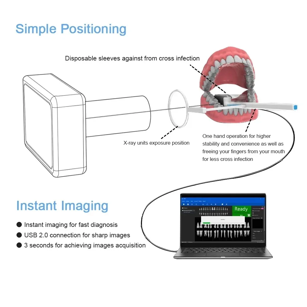 Professioneller Dental-Röntgensensor - Radiovisiograph-Bildgebungssystem - Hochfrequenz-Intraorale Filmarbeit & Kamera-Zahnmedizinische Ausrüstung – Detail 6