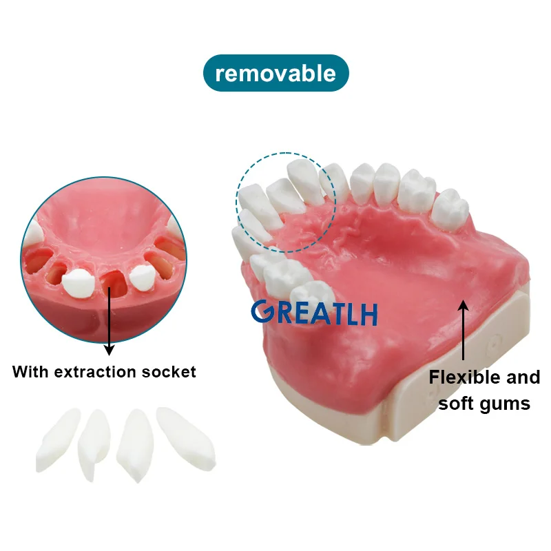 Dental Implant Model Maxillary Missing Resin Bionic Model Implant Practice Model Dental Instrument