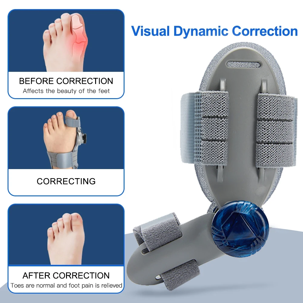 Adjustable Hallux Valgus Big Toe Corrector Orthopedic Bunion Corrector Splint Toe Separator Splint Straightener Foot Care