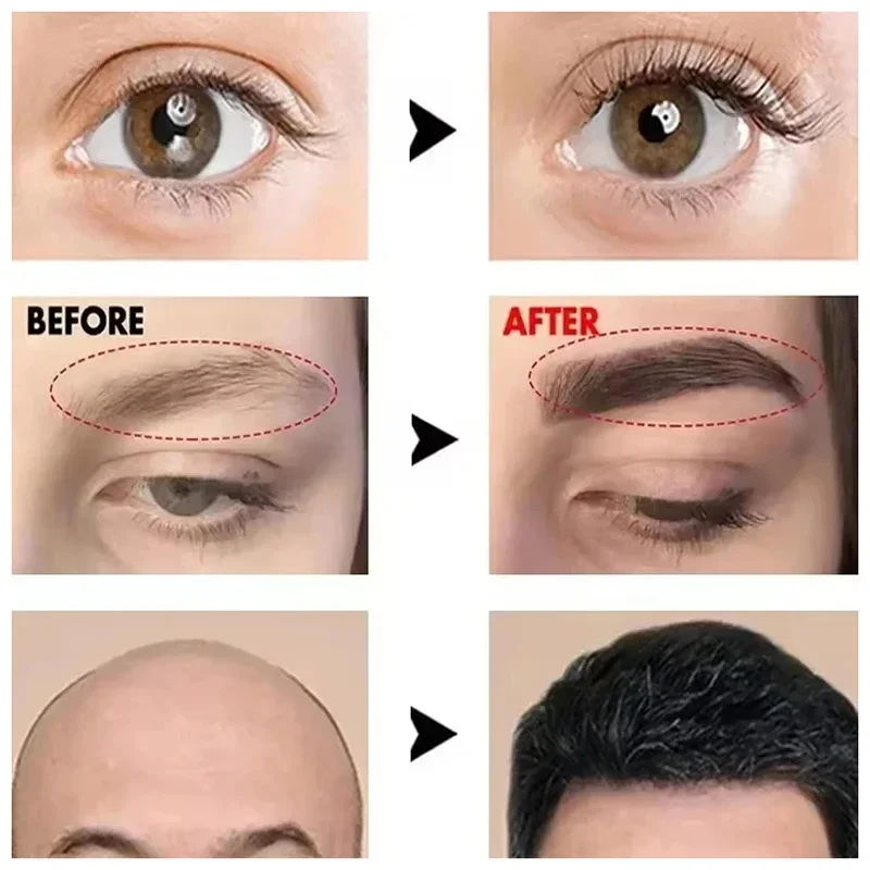 Soro de crescimento rápido de sobrancelha, crescimento de cabelo de cílios, prevenção de calvície, mais grosso, anti perda de cabelo, alongamento de sobrancelha, maquiagem nova