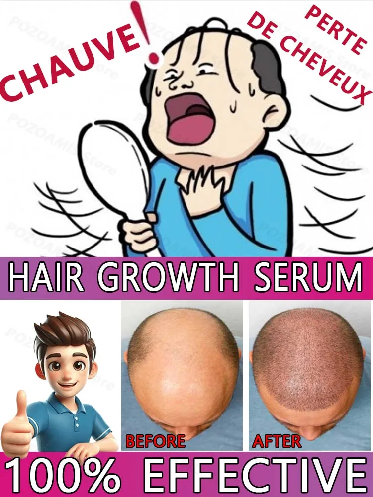 

Твые слепые финики всегда волнистые Может быть проблема не твое лицо, но твое голово! Подробности определение успеха или неудачи