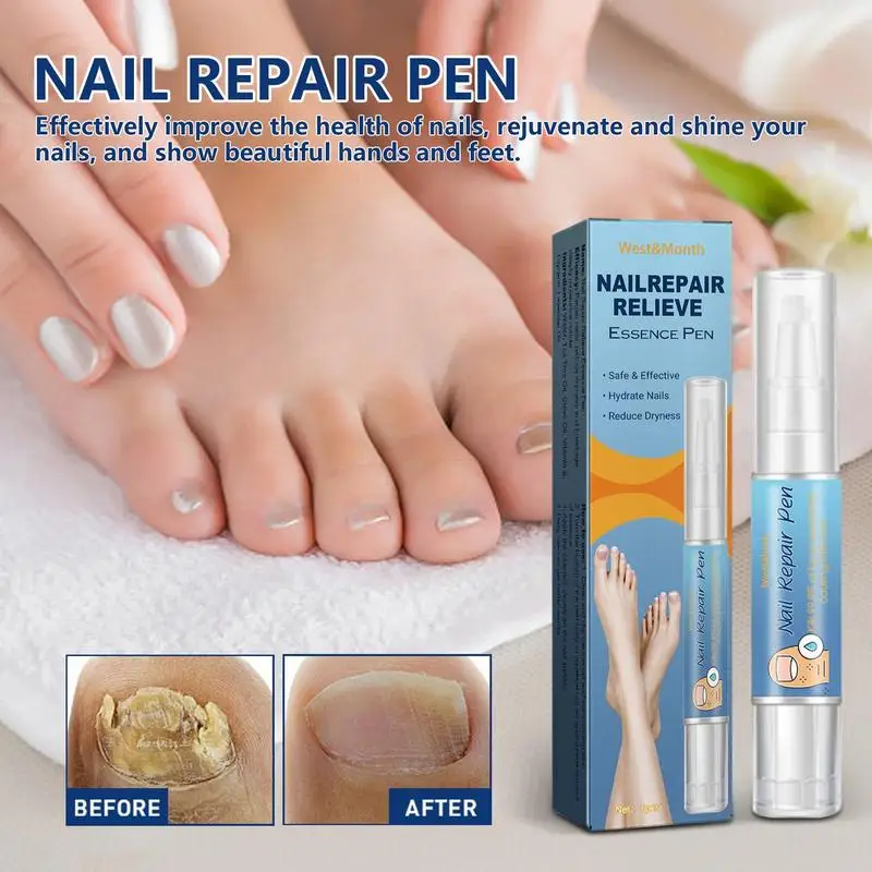 Portátil Toe Nail Tratamento Pen, Renovação unha, Reparação Eficaz, Cracking descolorido