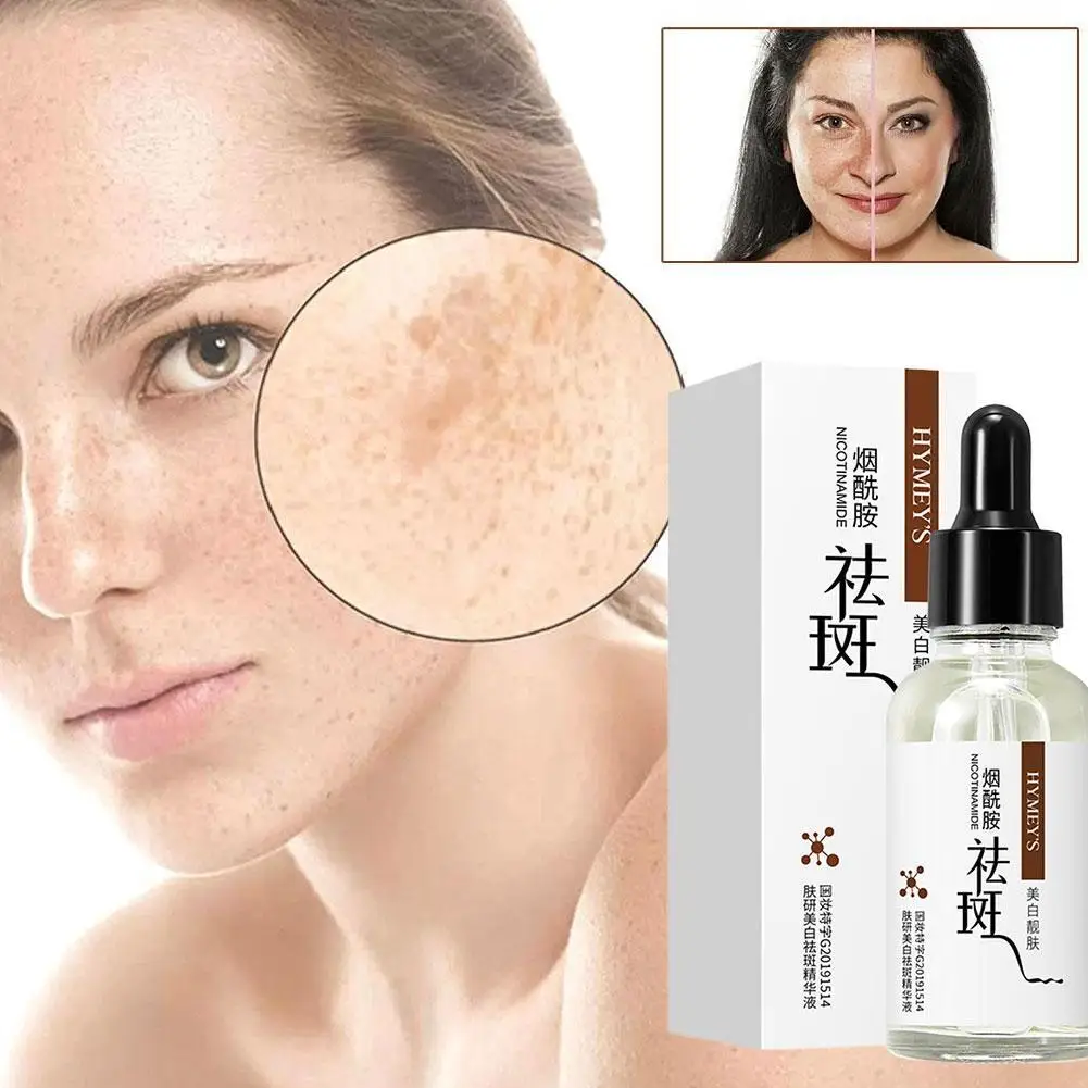 

30ml Freckle Removing Whitening Essence Fade Pigmentation Melasma Dark Spots Corrector Repair Serum Korean Skin Care