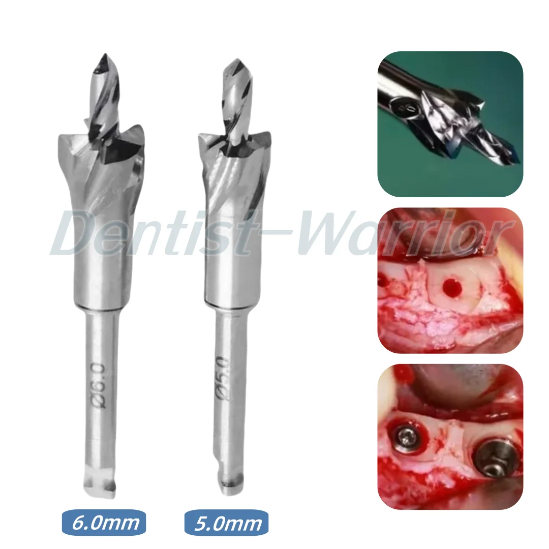 Dental Implant Bone Profiler Grinding Bur Surgical Instrument With Pilot Drill Contouring Drills Trimmer Collector Kit