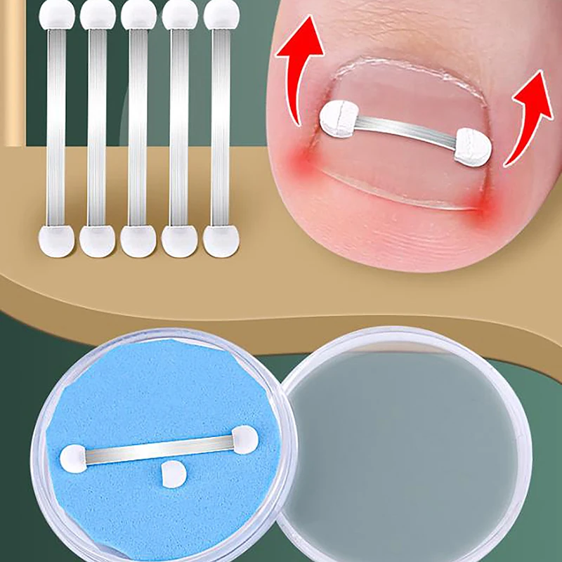 Outils de pédicure professionnels pour les ongles incarnés, gélatine de récupération, traitement des ongles Parker, outil de soin des pieds