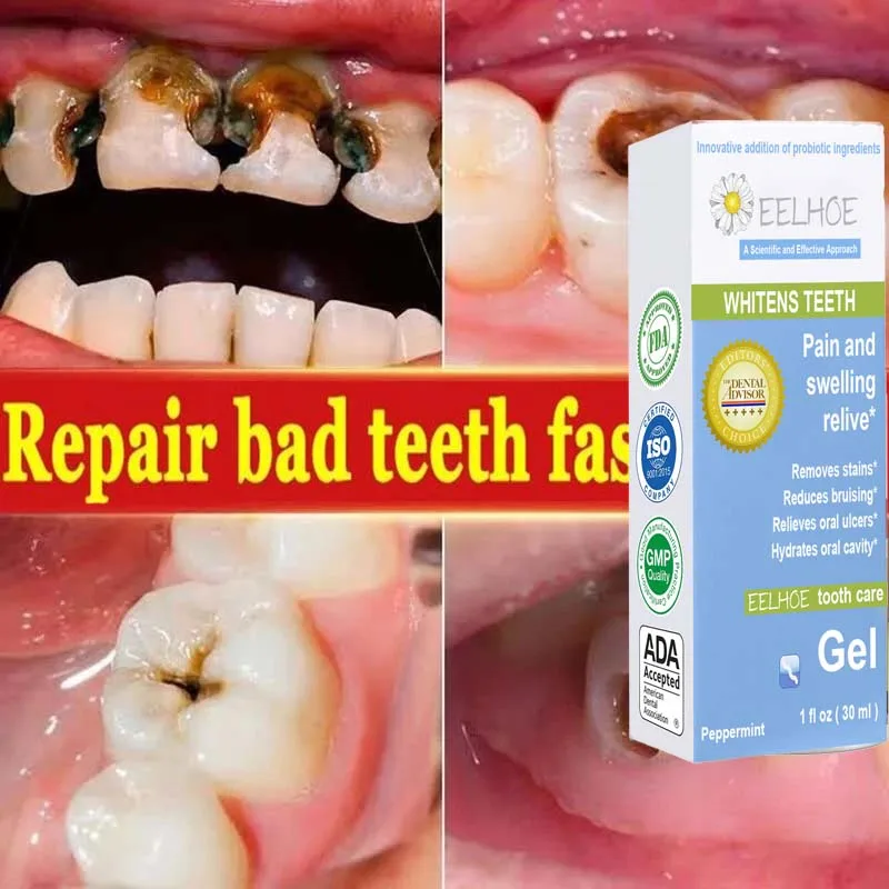 High Quality Anti-cavity Toothpaste Gel Decay Fresh Breath Repair Tooth Decay Remove Plaque Relieve Toothache Periodontity