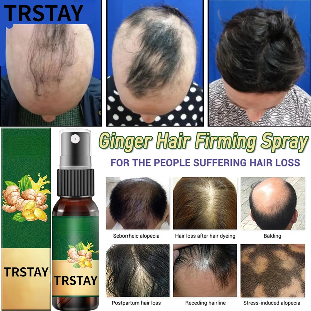 TRSTAY Ginger Essential Hair Growth Spary 30ML Hair Care Hair Growth Essential Anti Hair Loss Liquid Boost Hair Growth Spary