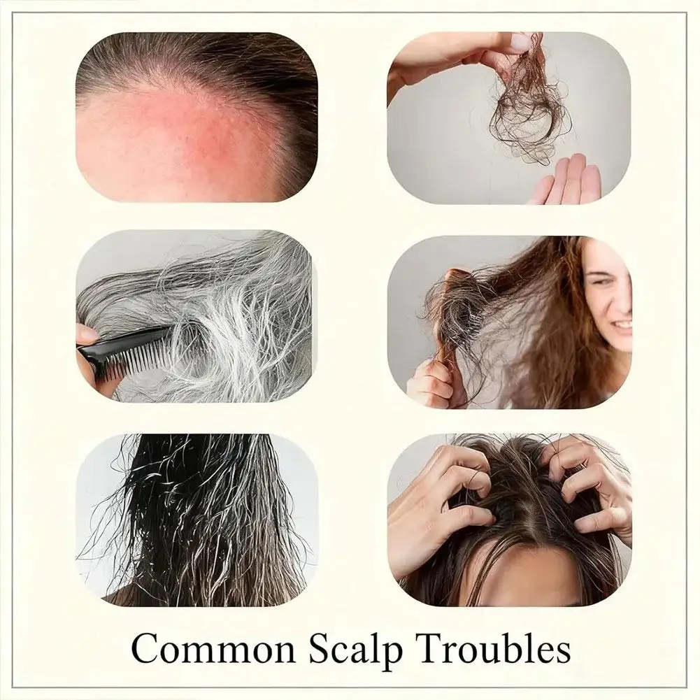 شامبو مكثف مضاد لتساقط الشعر، مستخلص نباتي من الكيراتين يقوي هيكل الشعر ويقلل كسر الشعر الملون أو المضاد #2