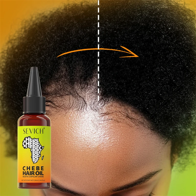 Chebe Fast Hair Growth Oil Africa Traction Alopecia Chebe Oil Nourishes Repair Damaged Hair Treatment Oil Anti-Hair Loss Care - view 3