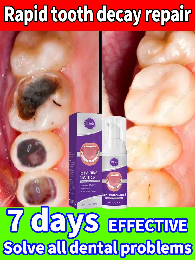 Solves caries and tooth decay problem