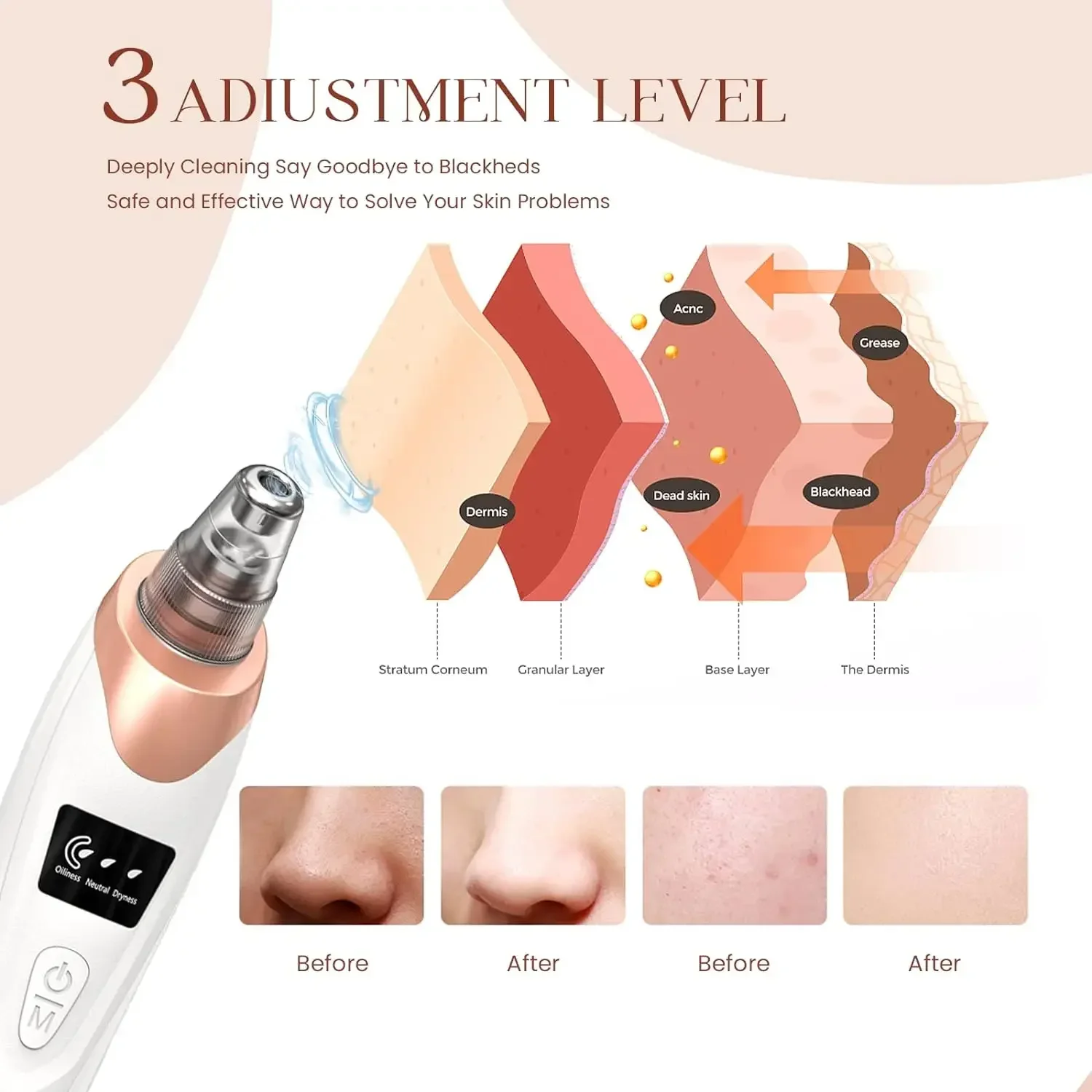 Cravo Blotter Facial Poros Limpador Removedor De Acne Recarregável Pequeno Bubble Blotter Limpeza Máquina De Pele Vibração Plasma Pen