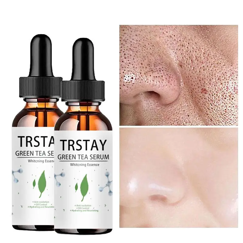 GreenTea-esencia de poro, equilibrio, Control de aceite, reparación hidratante, loción para acné, suero reductor de piel, crema blanqueadora de Estiramiento facial
