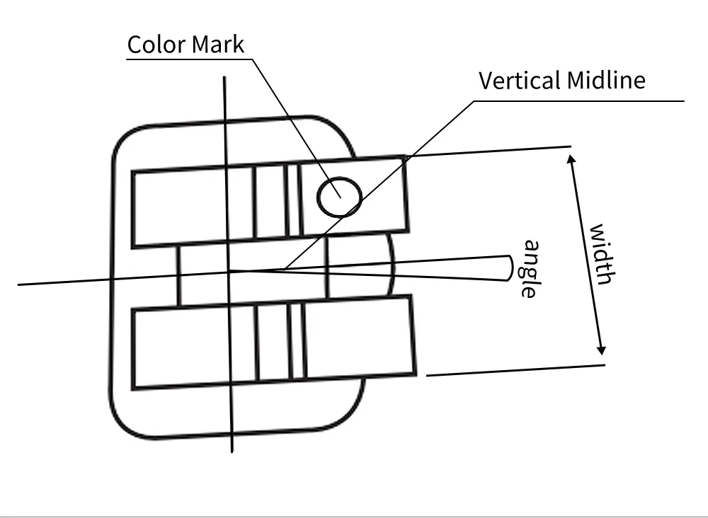 AZDENT 3 Boxen Zahnkieferorthopädische Halterung Hosenträger Mini Roth MBT 022 018 Haken 345 MIM Monoblock Metallklammern Zahnmaterialien – Detail 7