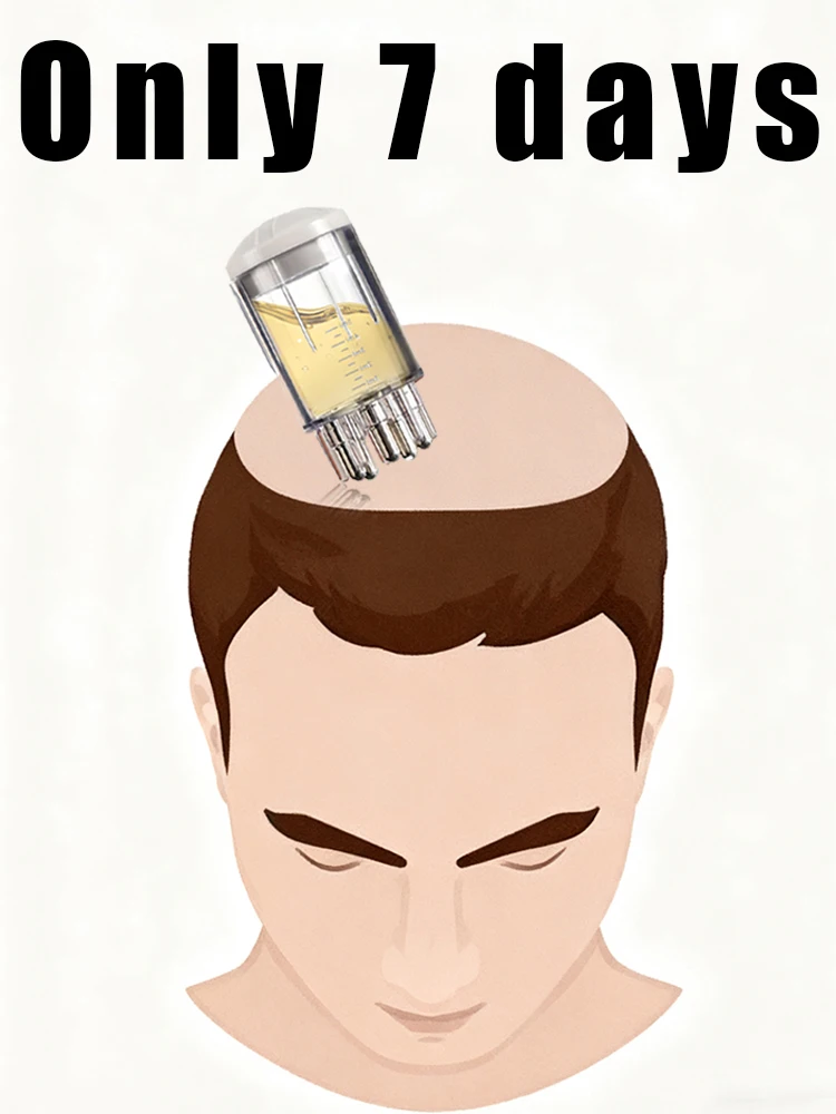 

Highly rated, free shipping. Promotes gentle hair follicle regeneration, say goodbye to embarrassing baldness.