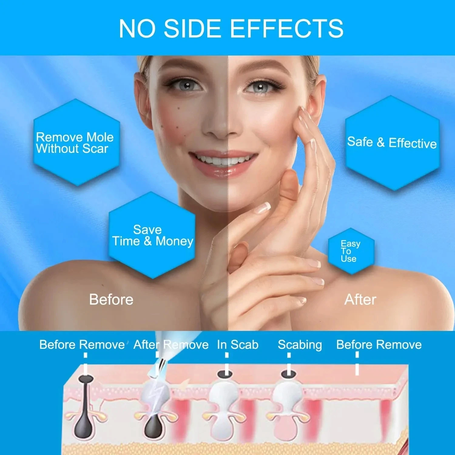 Caneta portátil para cuidados com as manchas da pele, nível ajustável, ferramenta de beleza para refinar a pele, display led, dispositivo pessoal para cuidados com a pele