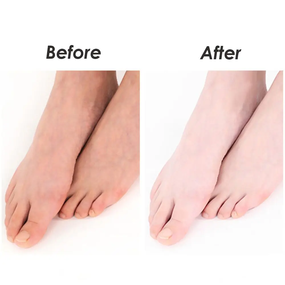 1 paio Pedicure Callus Peeling calzini nutrienti Scrub esfoliante Patch per piedi Camel Milk Foot Mask Anti Crack