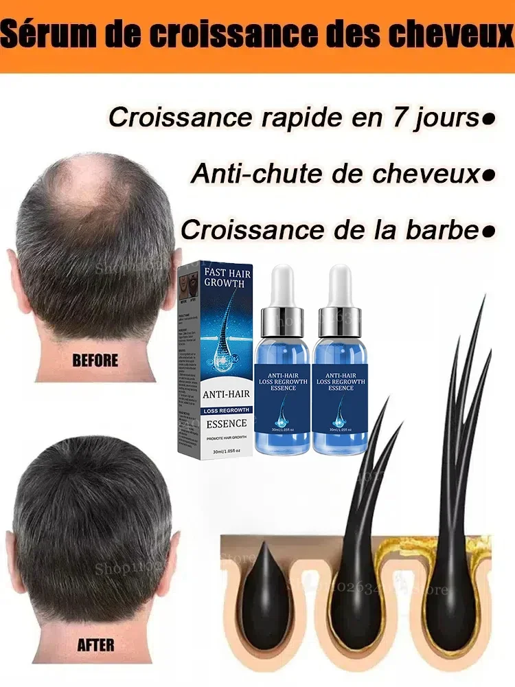 

Unlock the Secret to a Thicker, Healthier Hairline