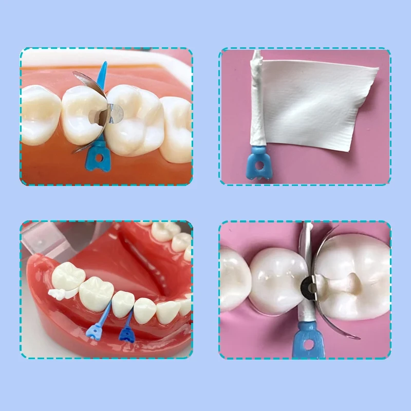 Dental Teflon Matrix Bands PTFE Rohstoff Gürtel Mit Cutter Schnitt Matrix System Tulwar Wedge Refill Wedge Zahnarzt Material – Detail 4