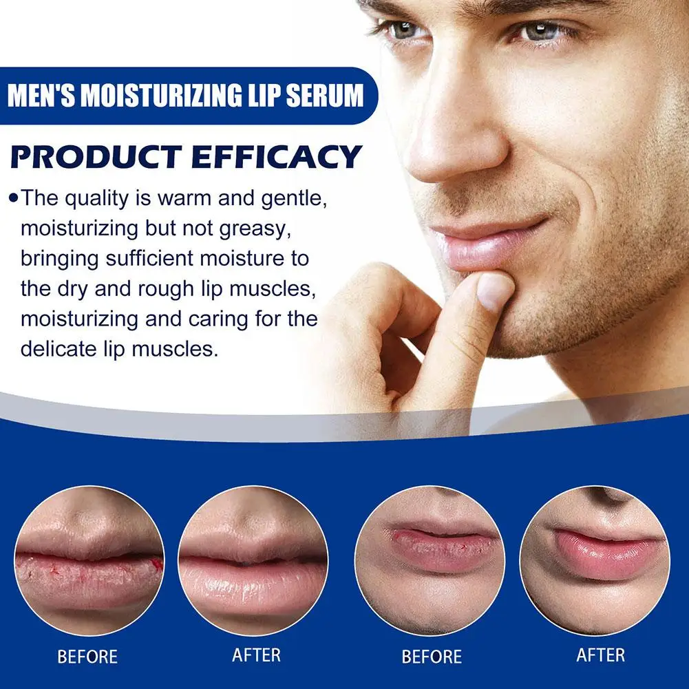 مصل الشفاه الأساسي للرجال تفتيح الشفاه والخطوط الدقيقة المتشققة وتحسين جفاف الهيالورونيك للعناية بالشفاه جوهر الشفاه